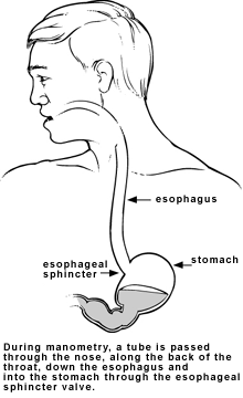 Esophageal manometri test