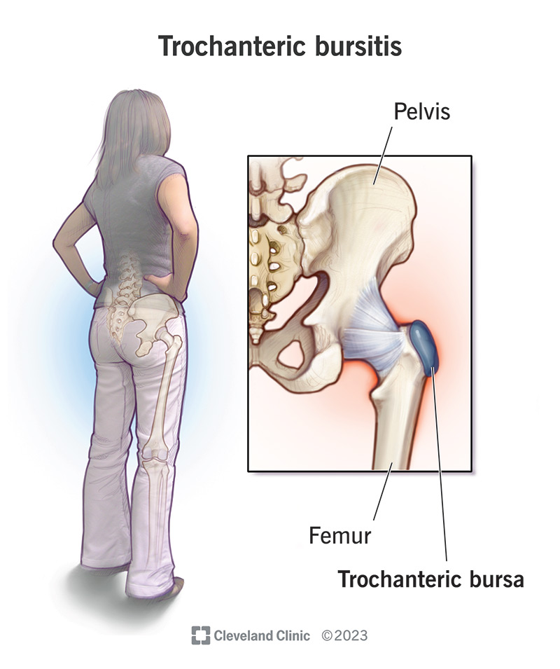 Hip Pain at Night: Causes, Treatment, Exercises