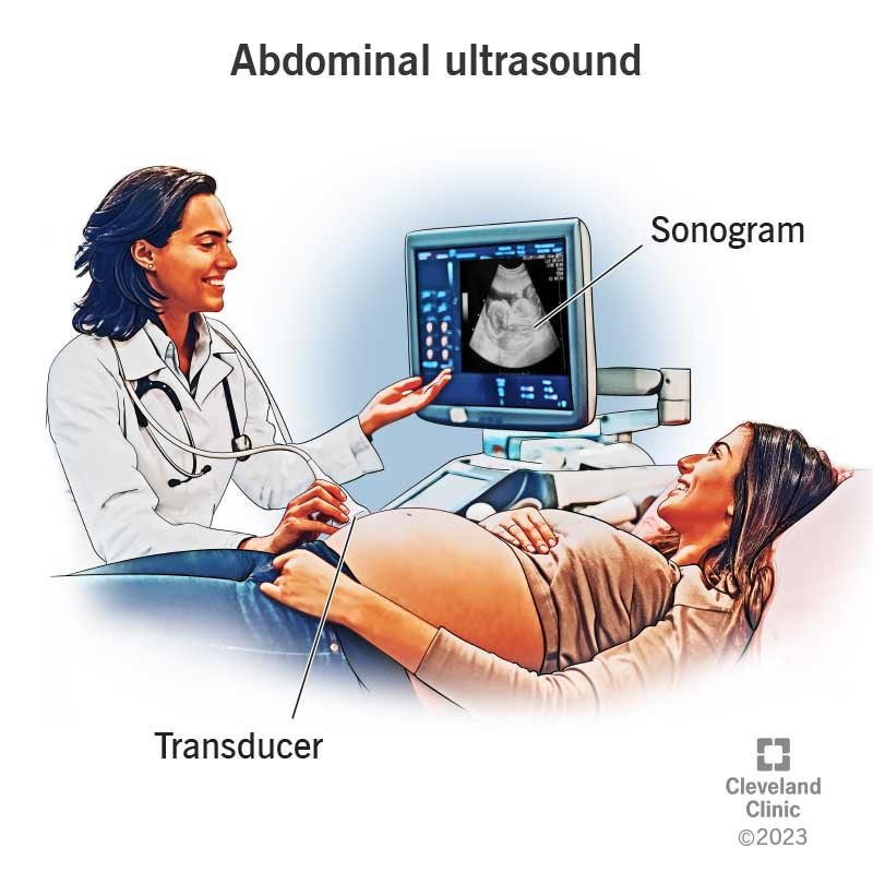 During an abdominal ultrasound, a provider places a transducer on your belly and an image displays on a screen.