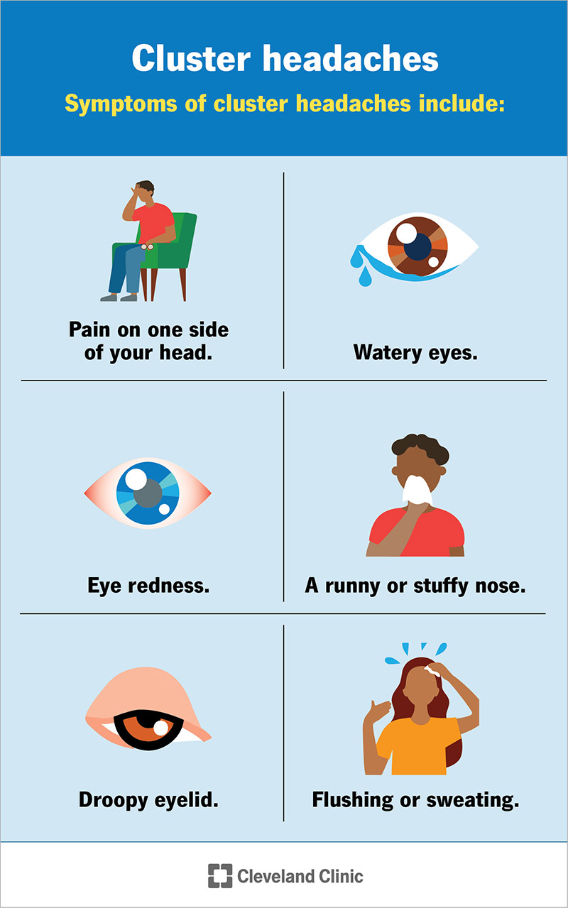 Cluster Headache What It Is Causes Symptoms Treatment