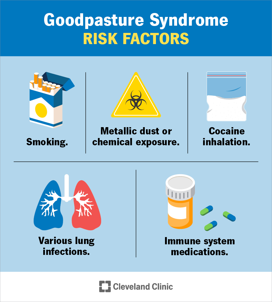 Smoking, metallic dust and chemical exposure, cocaine use and lung infections may increase your Goodpasture syndrome risk.