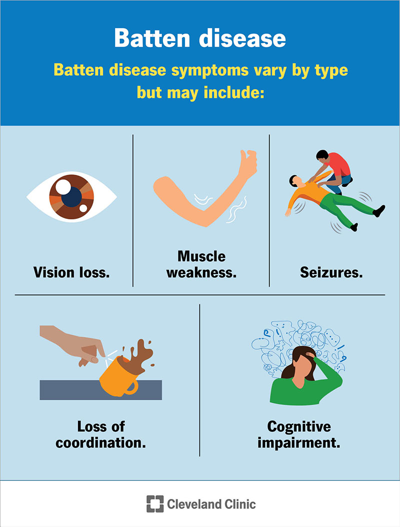 Common symptoms of Batten disease that affect most types.