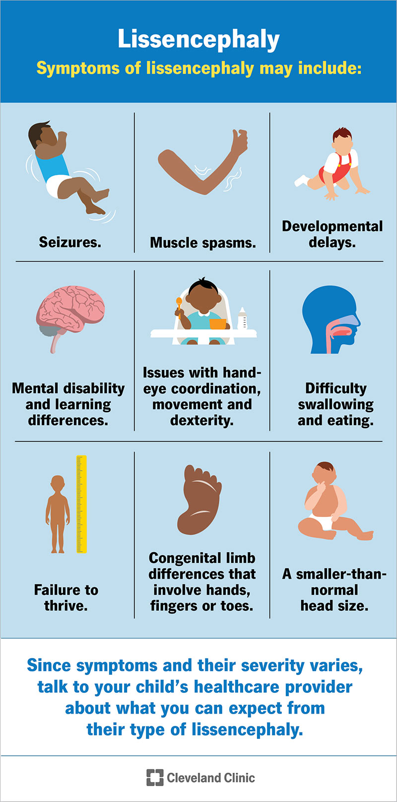 Symptoms of lissencephaly may include: seizures, muscle spasms, developmental delays, failure to thrive, smaller-than-normal head and more.