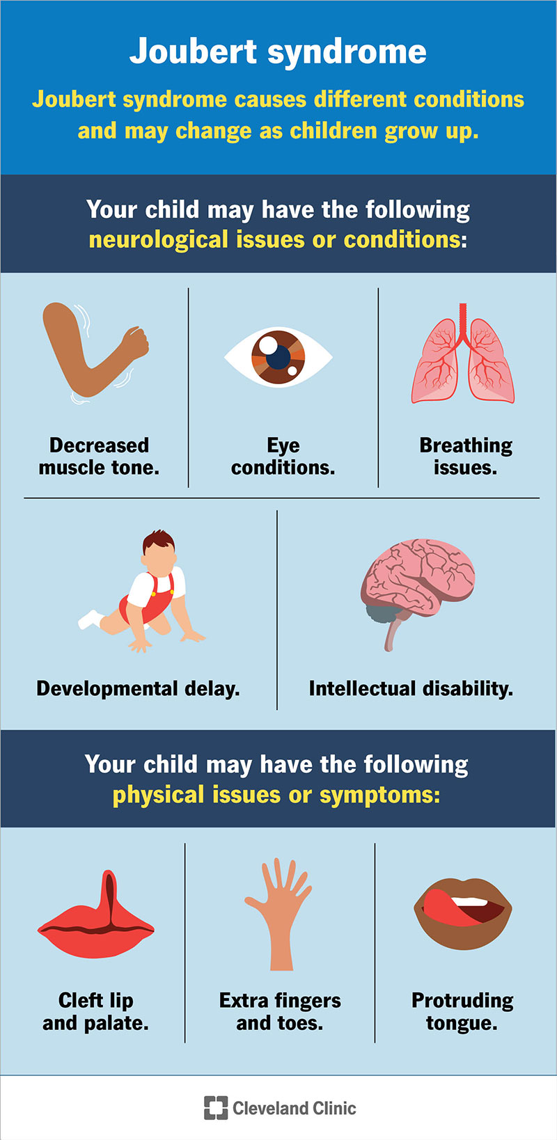Joubert syndrome is a rare genetic disorder that can cause neurological issues (top) or physical symptoms (bottom).
