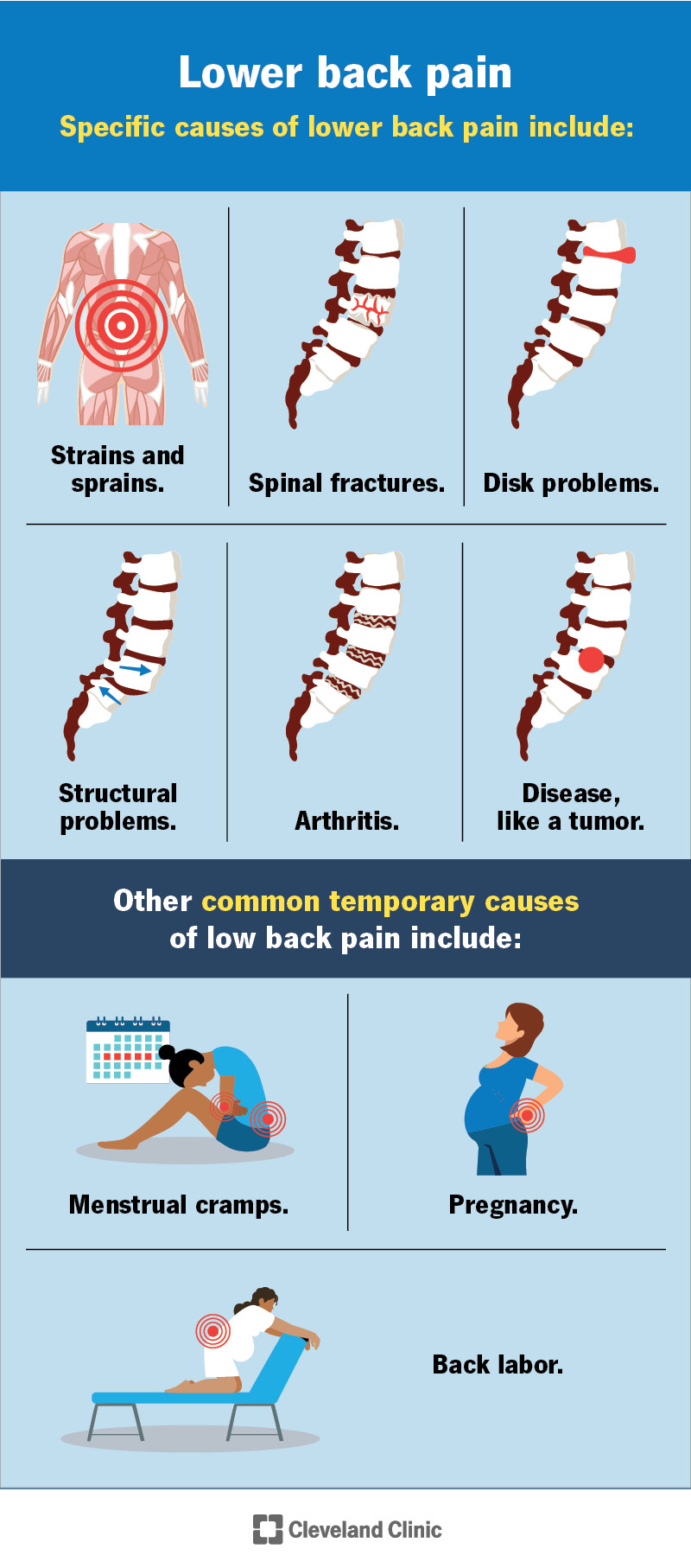 Lower Back Pain Causes Symptoms Treatment