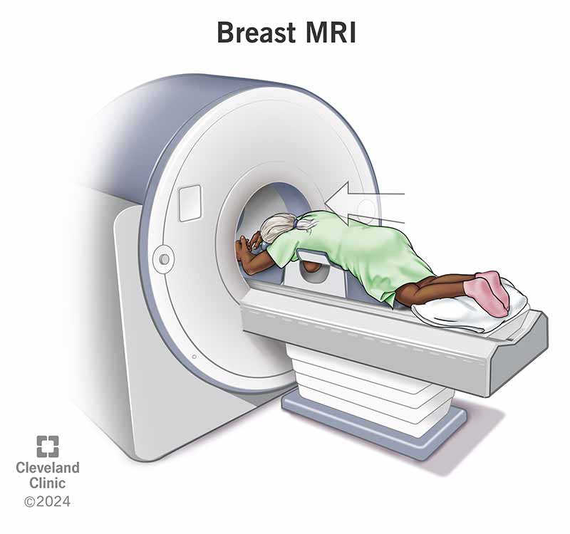 A person lying on their stomach on an exam table going head-first into the opening of an MRI machine, shaped like a donut.