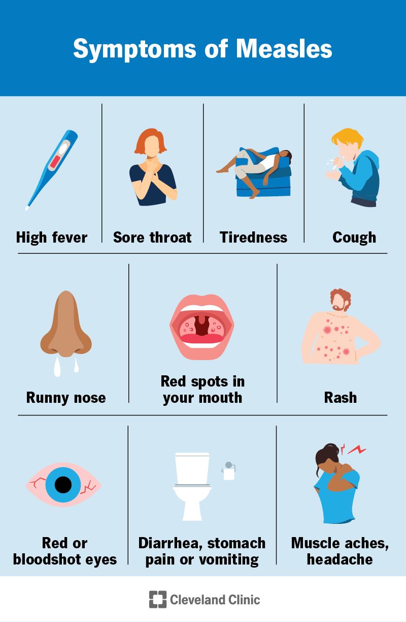 Measles symptoms include rash, fever, sore throat, red spots in your mouth, red eyes, runny nose, cough, headache and more