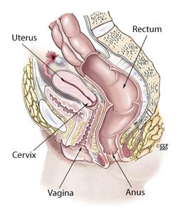 Pelvic Inflammatory Disease Causes Symptoms Treatments