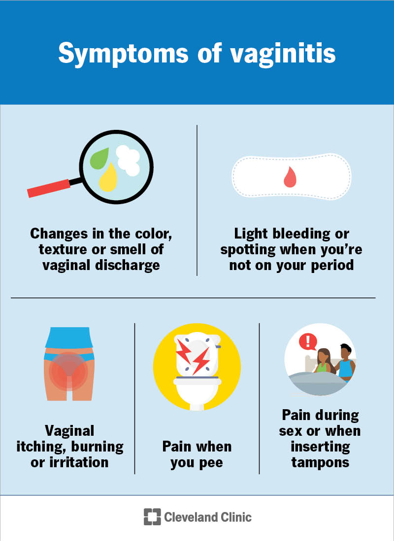 Common symptoms of vaginitis include changes in vaginal discharge, spotting, burning or irritation or pain during sex