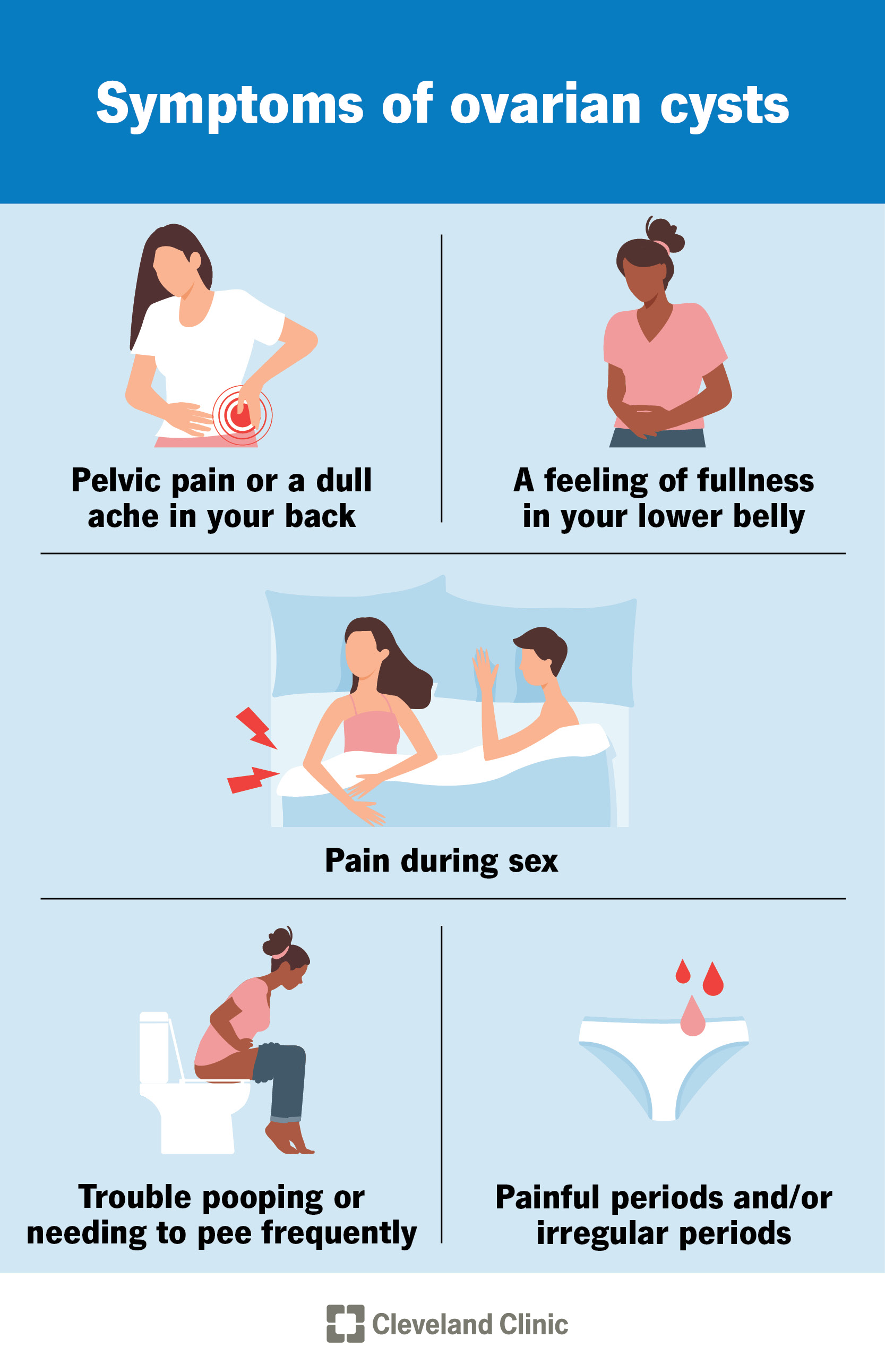 Common symptoms of an ovarian cyst include pelvic pain, irregular periods or pain during sex