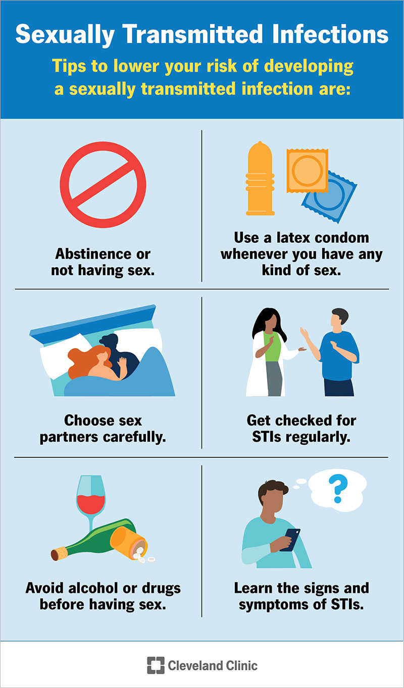 Six tips to reduce your risk of developing a sexually transmitted infection.