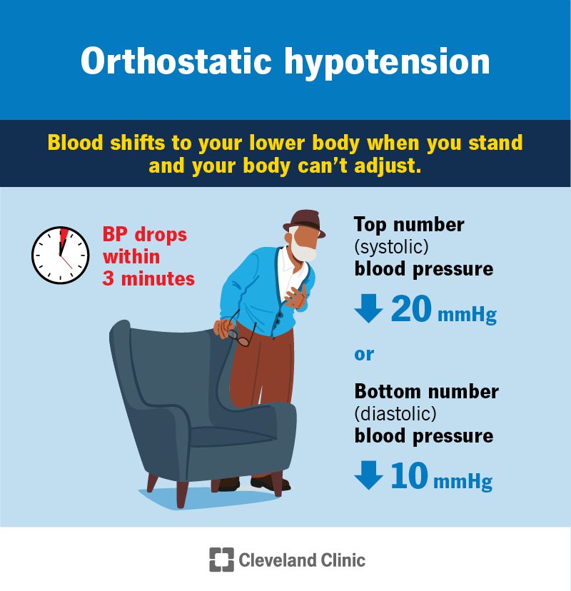Orthostatic hypotension is a quick drop in blood pressure (in the top or bottom number) when you stand up