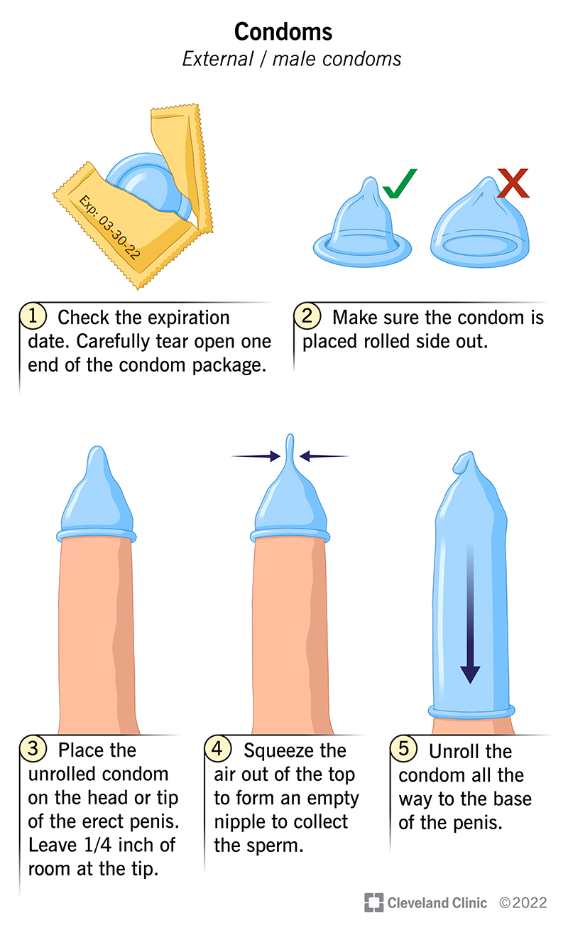 Step-by-step guide to putting on a condom.