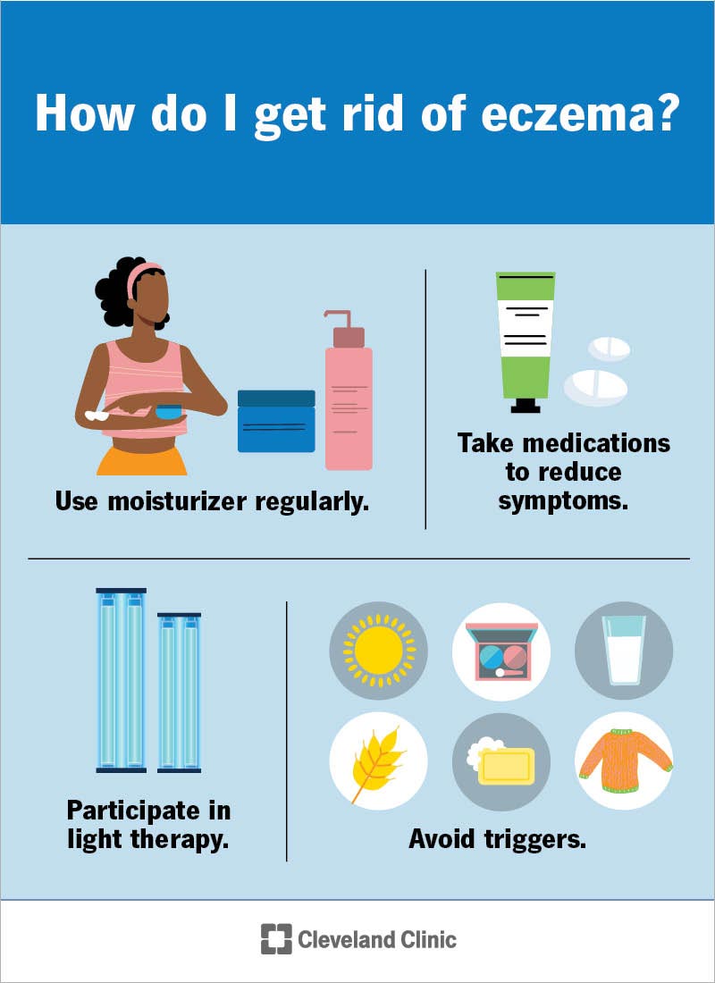 Types of deals eczema