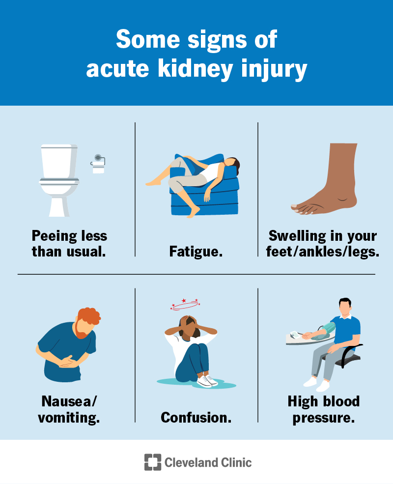 Some acute kidney injury symptoms, including changes to peeing habits, feeling very tired, swelling and nausea