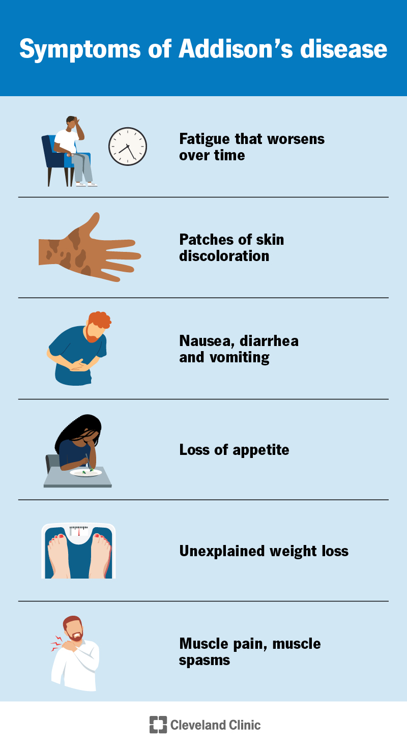Symptoms of Addison’s disease, including fatigue that gets worse over time, skin discoloration and nausea and vomiting