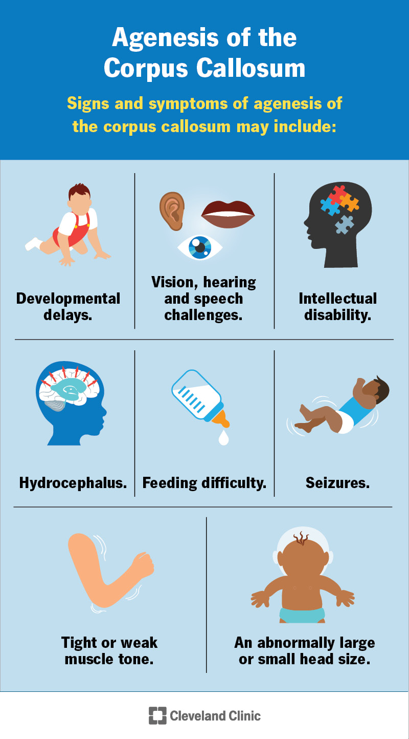 Common signs and symptoms of agenesis of the corpus callosum.