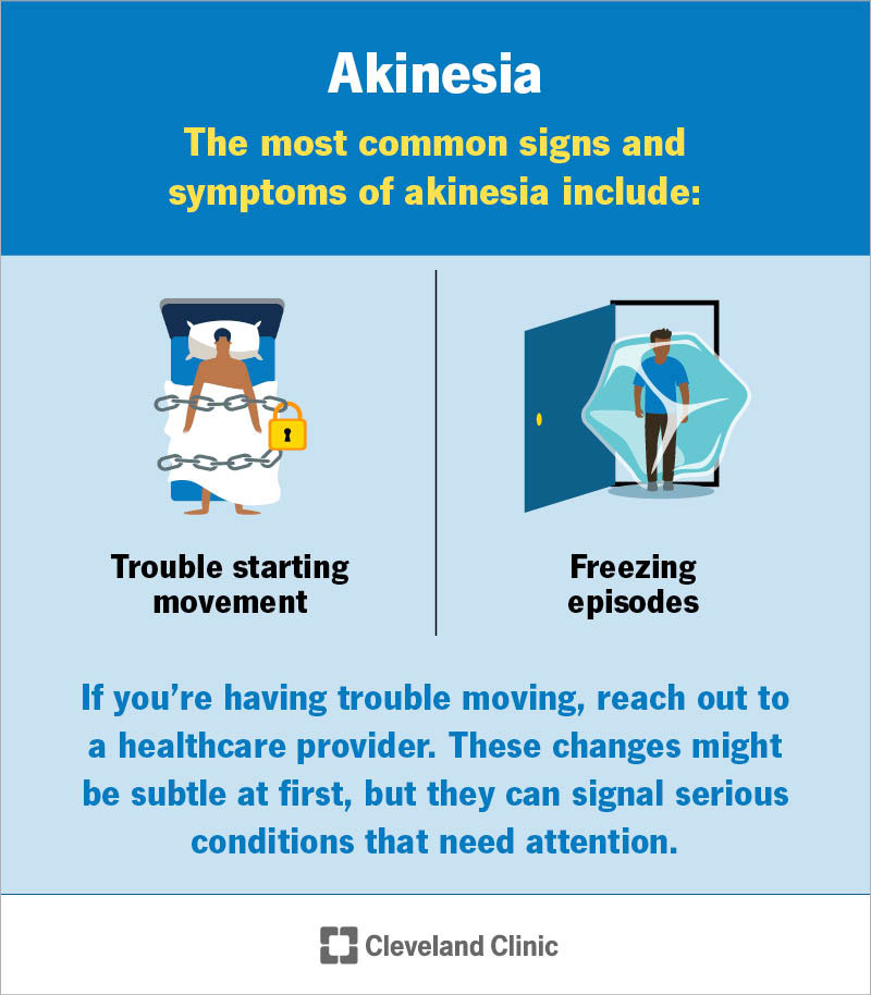 Common akinesia signs and symptoms