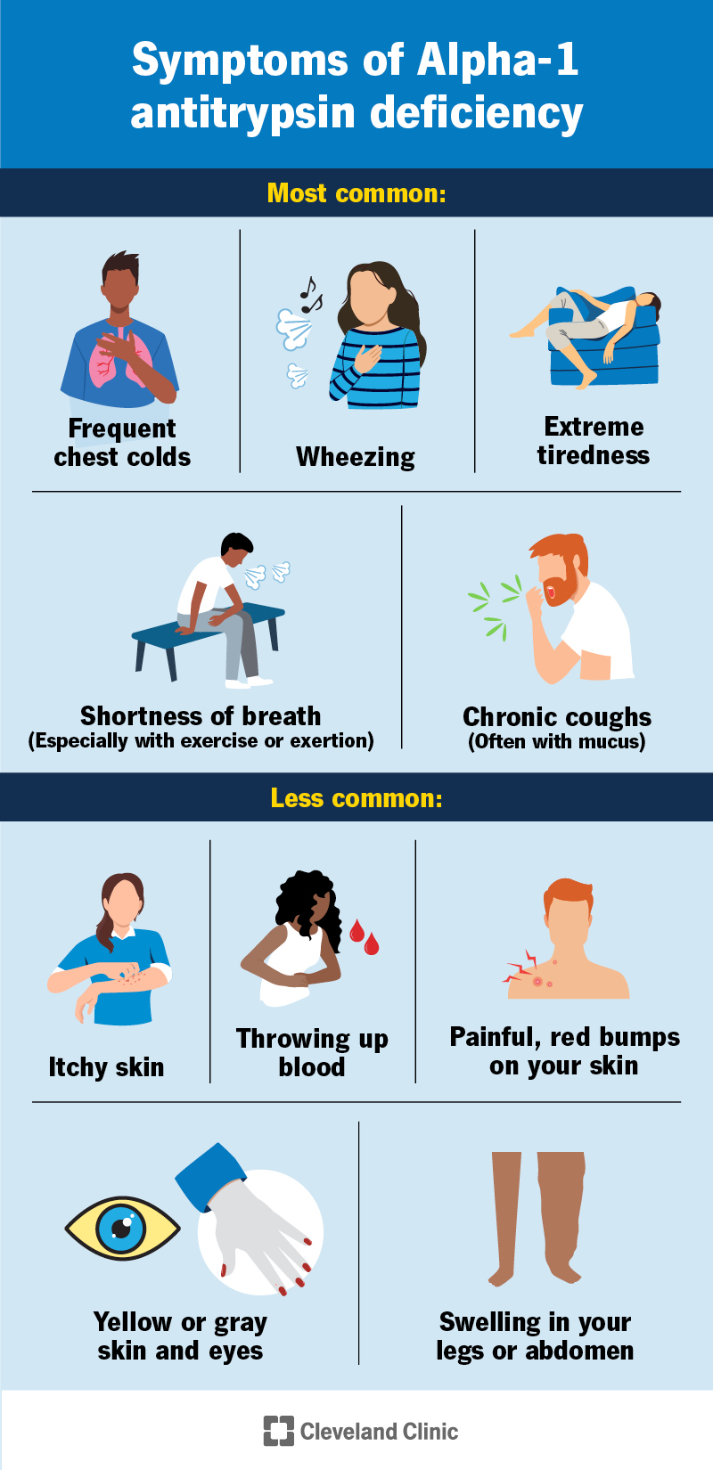 Symptoms of Alpha-1 antitrypsin deficiency, including wheezing, fatigue, shortness of breath, cough and chest cold