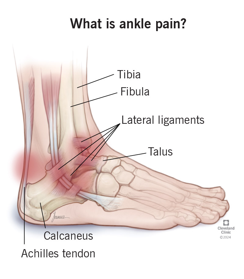 Your ankle is a complex joint made of three bones and lots of muscles, tendons and ligaments.