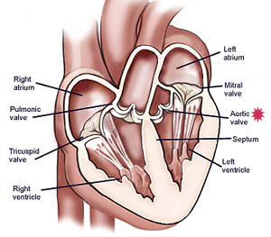 Aorta And Aortic Valve