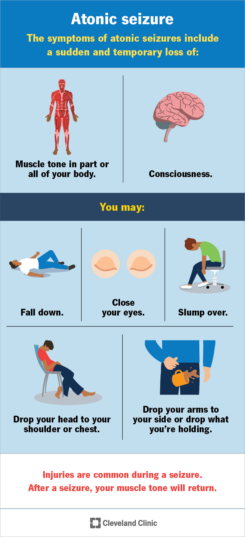 Symptoms of an atonic seizures include sudden and temporary loss of muscle tone and consciousness