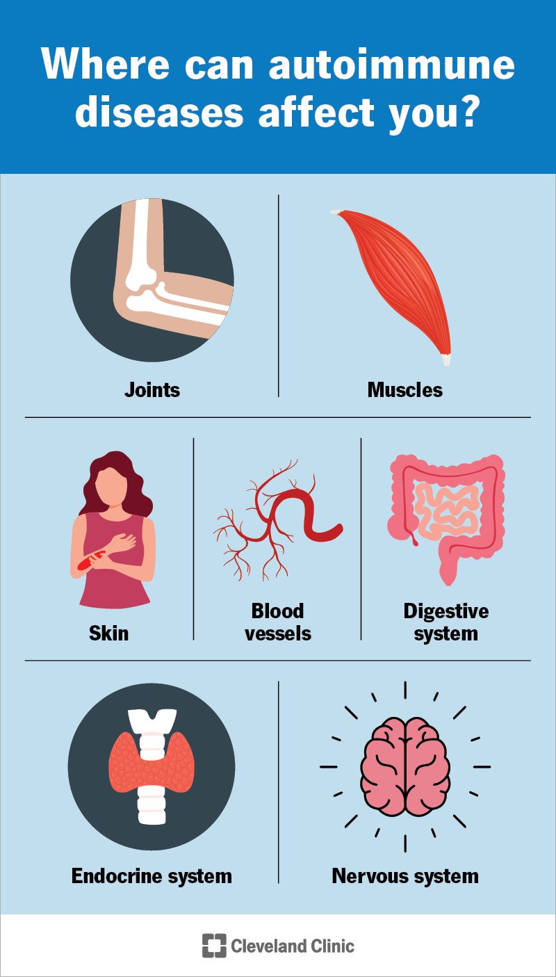 There are more than 100 different autoimmune diseases that can affect almost any part of your body.