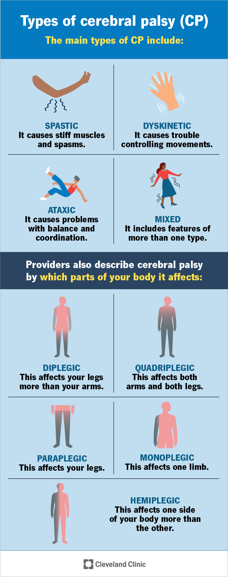 Cerebral palsy types and body parts affected, including spastic and hemiplegic