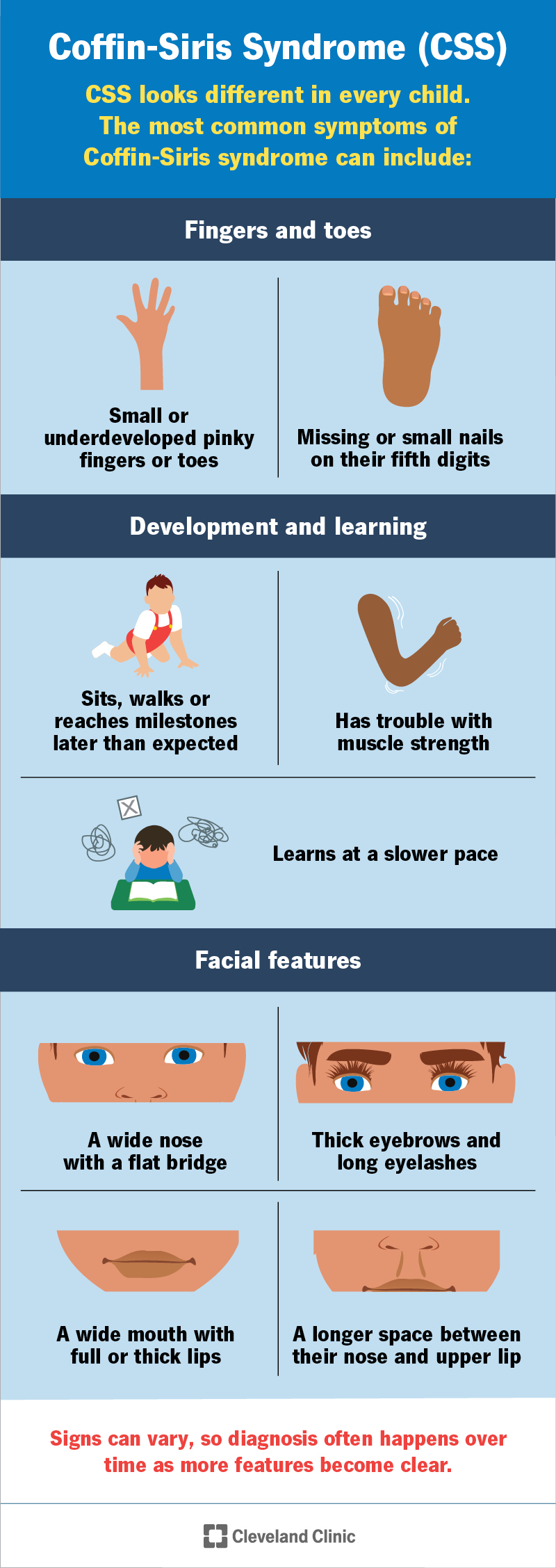 Coffin-Siris syndrome symptoms, including underdeveloped fifth digits, developmental delays and unique facial features