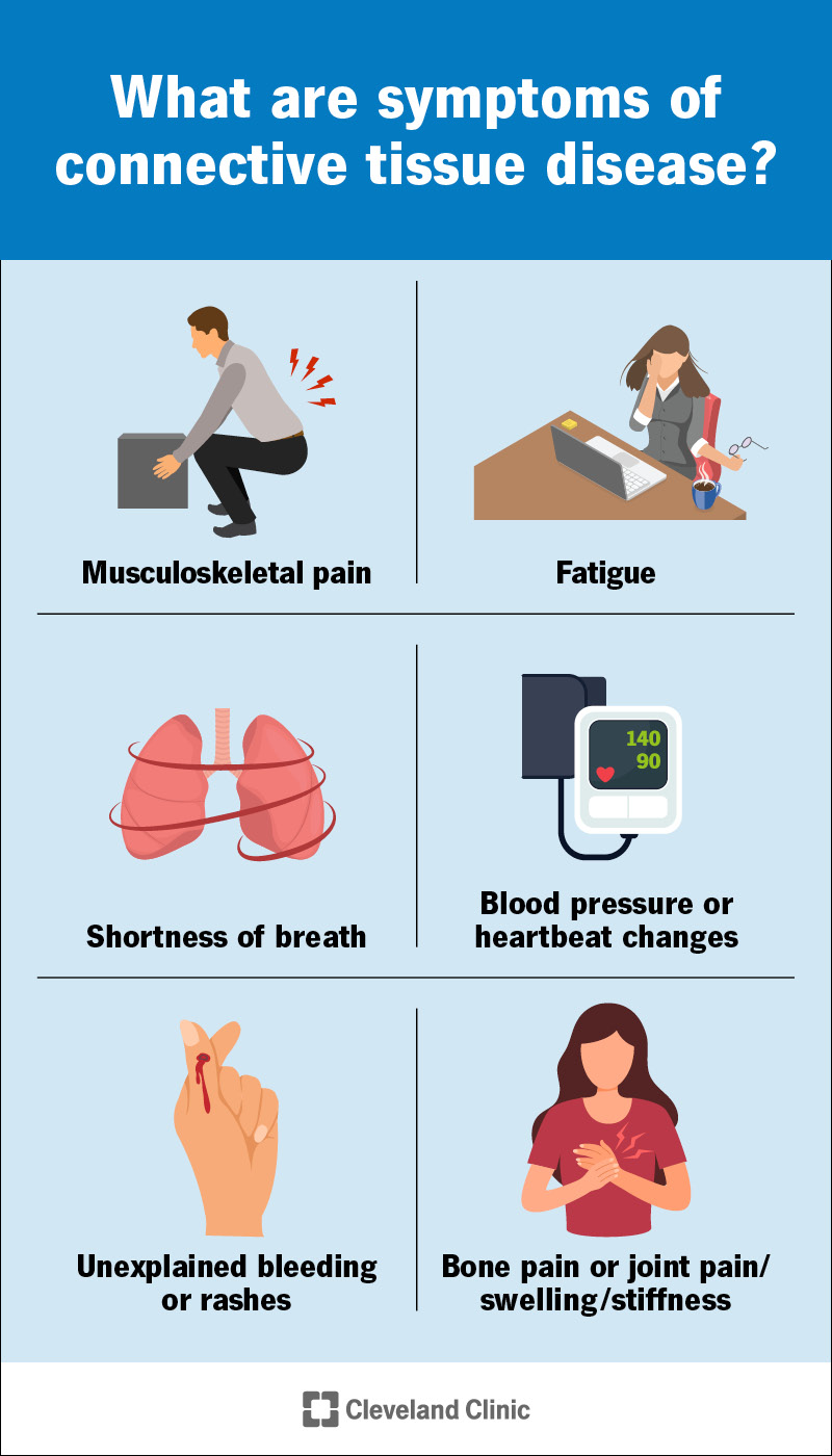 Common symptoms of connective tissue diseases include musculoskeletal pain and fatigue.