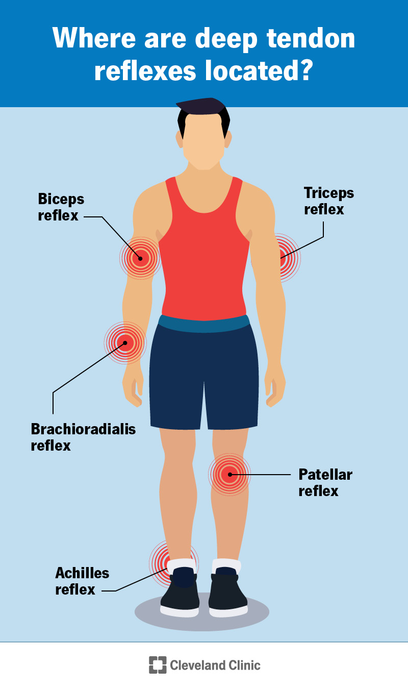 The deep tendon reflexes are the biceps reflex, triceps reflex, brachioradialis reflex, patellar reflex and Achilles reflex