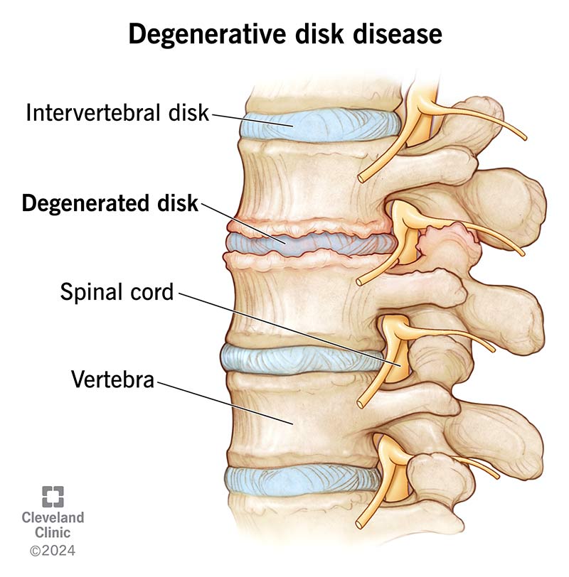 Lumbar Disc Joints The Different Parts Of The Spine Cary