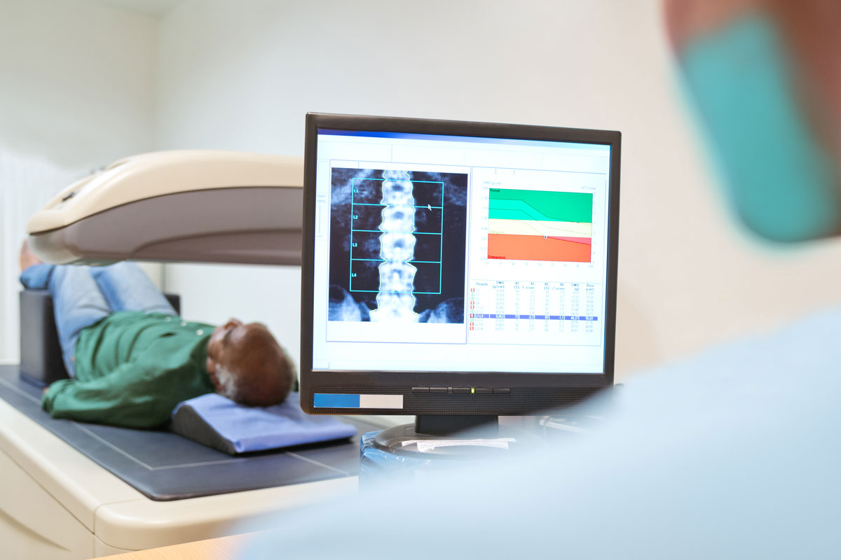 A DEXA scan uses X-rays to measure how much calcium and other minerals are in your bones.