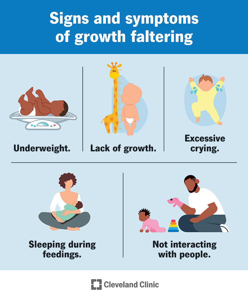 Signs of growth faltering include not gaining weight as expected or not growing in length or height