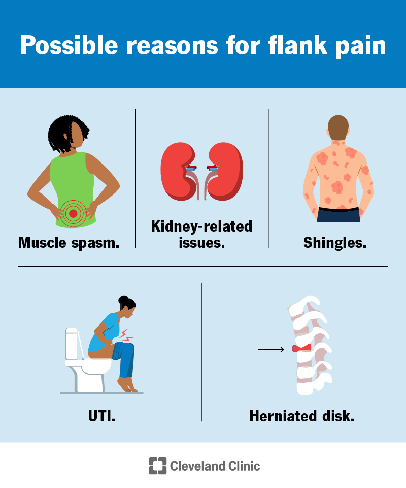 Flank pain can have many causes, including conditions that affect your kidneys, infections and muscle or spinal injuries.