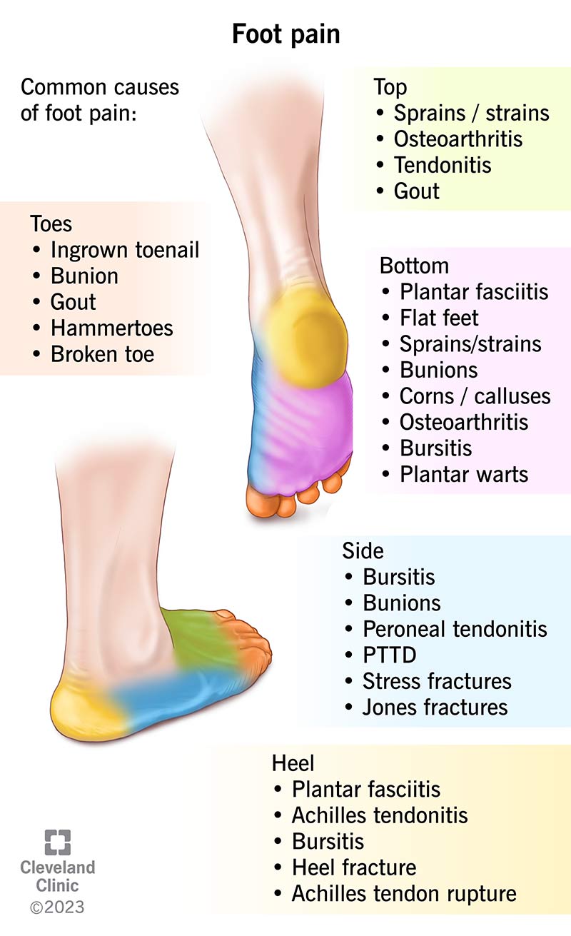 foot-pain-causes-treatment