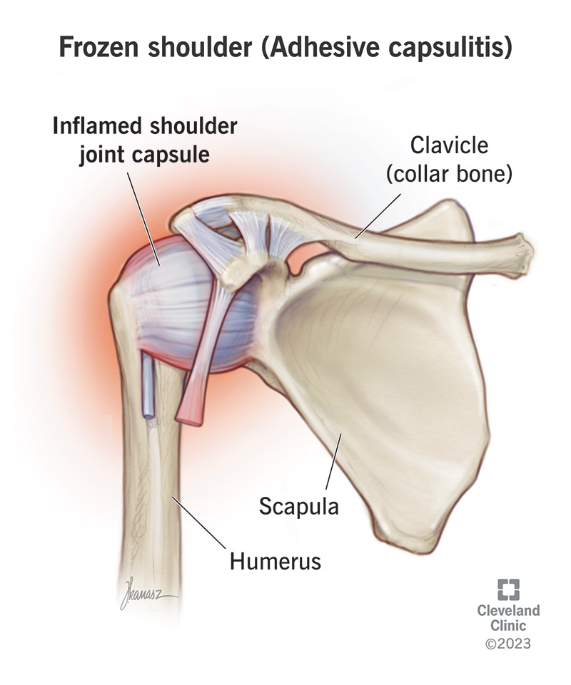 Anatomy of the scapula. Modified from Wikimedia. This file is