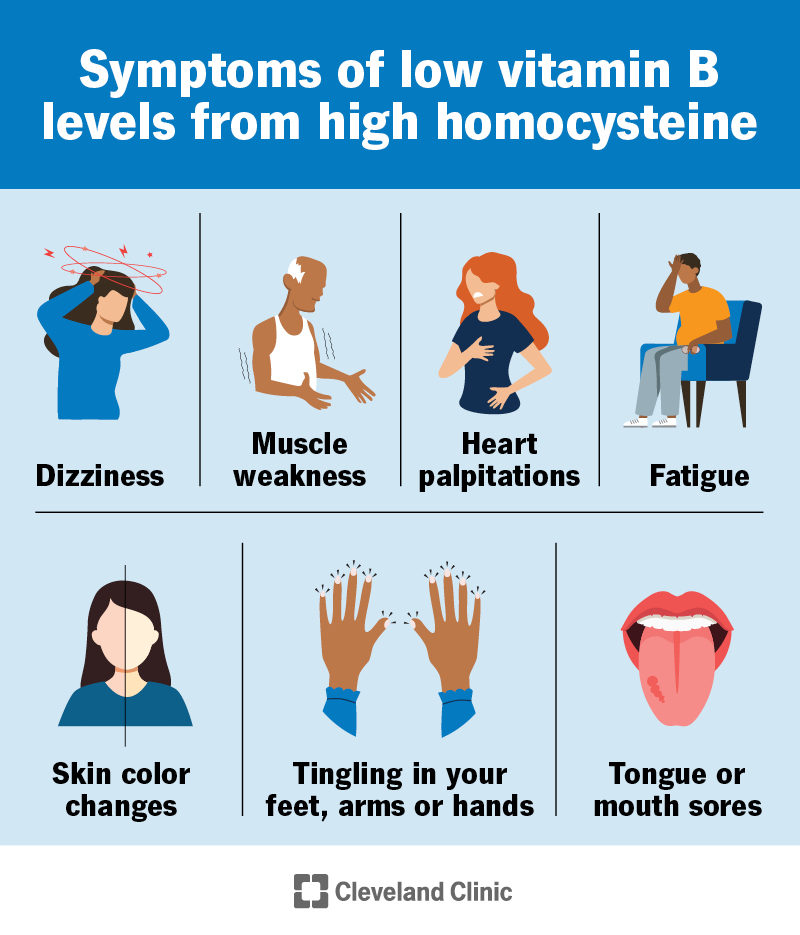 A high level of homocysteine can give you symptoms of low vitamin B levels