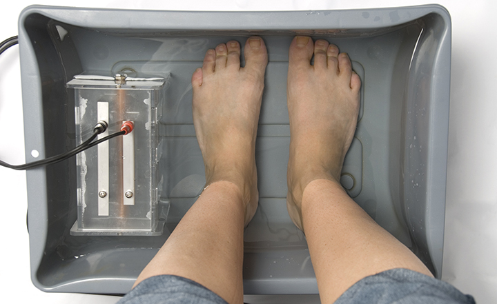 Iontophoresis for hyperhidrosis using a water bath and electrodes