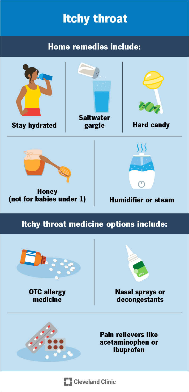 Home remedies and OTC medications for itchy throat