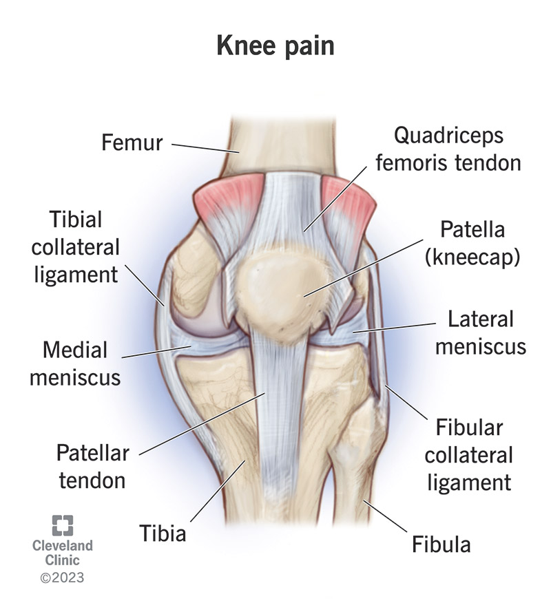 Injuries or irritation in any part of your knee can cause knee pain.