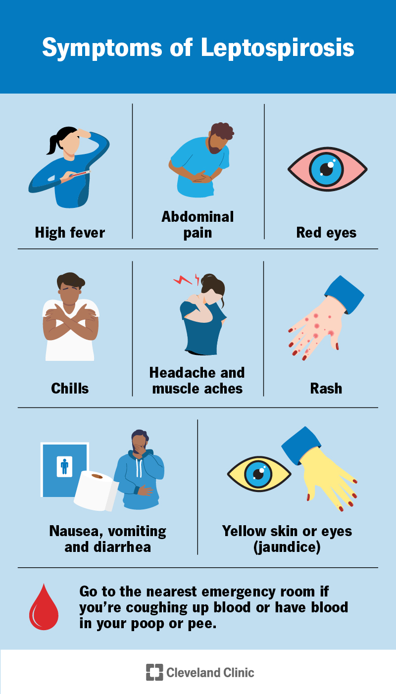 Symptoms of leptospirosis include high fever, red eyes, headache, muscle aches, abdominal pain, yellow skin or eyes and more