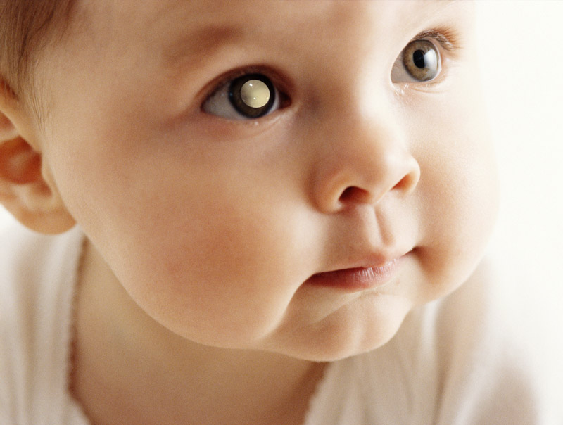 Blue Eyes: What Causes Them and How They Affect Health