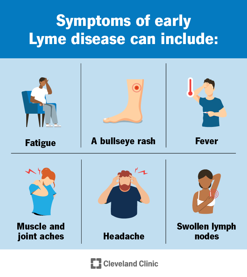 Symptoms of early Lyme disease can include a bullseye rash, fever, headache, body aches, fatigue and swollen lymph nodes