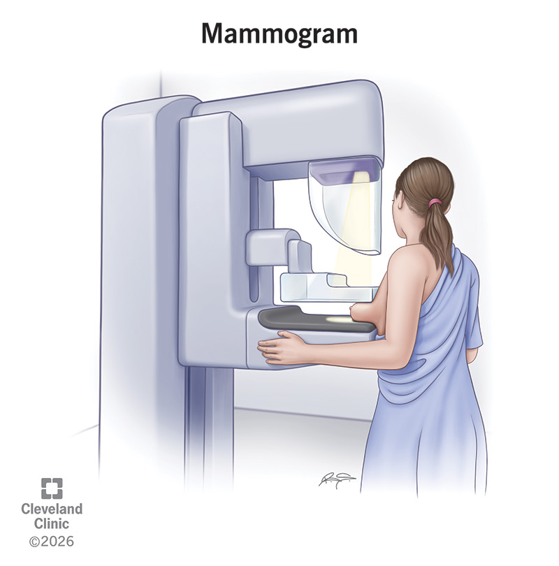 A woman getting a mammogram