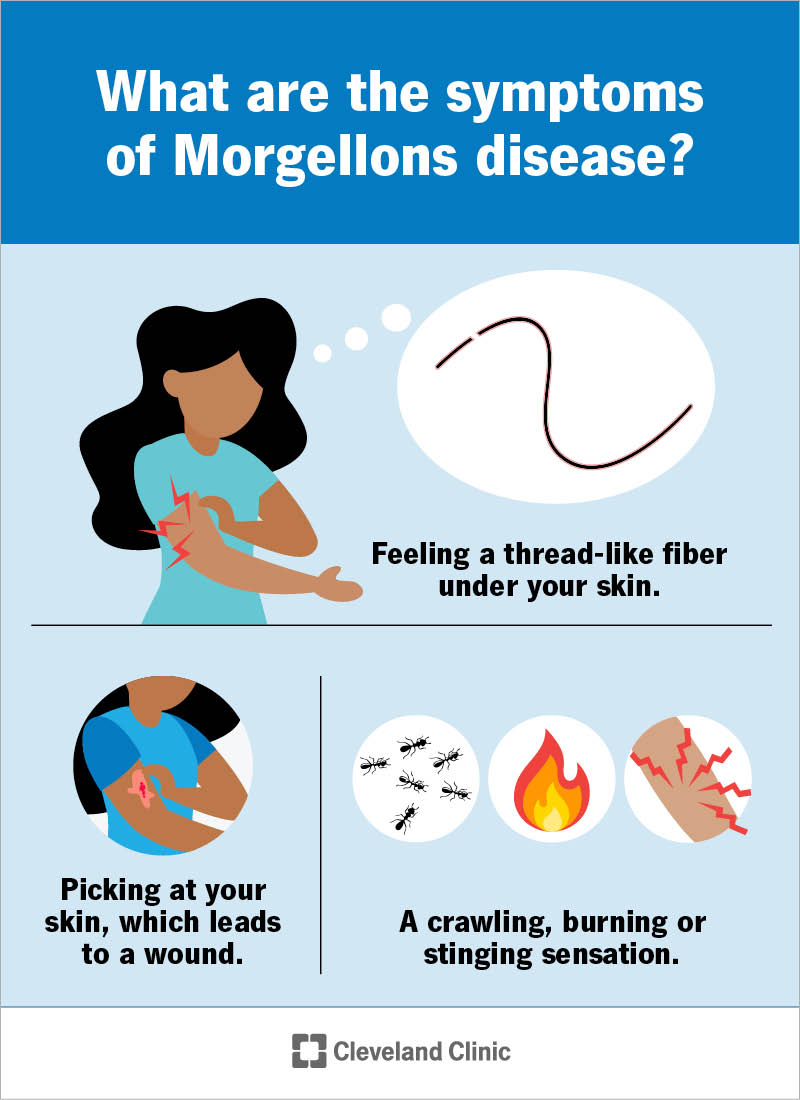 Person picking at irritated skin; Morgellons disease symptoms include crawling, burning and stinging sensations
