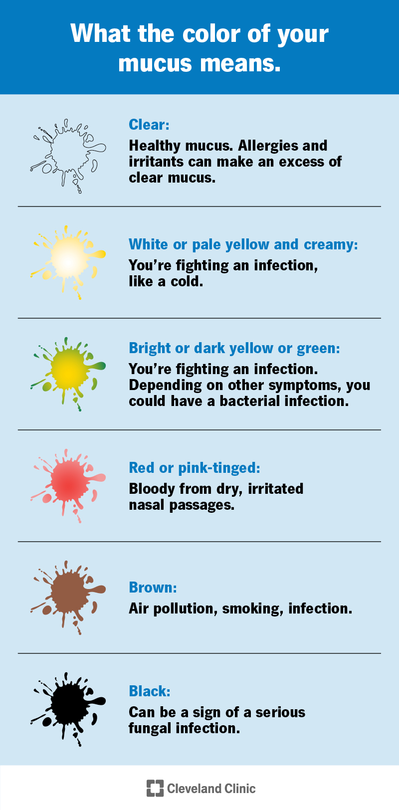 Image showing mucus colors. Infections can make your mucus white, yellow, green, brown or black. Blood can turn it red.