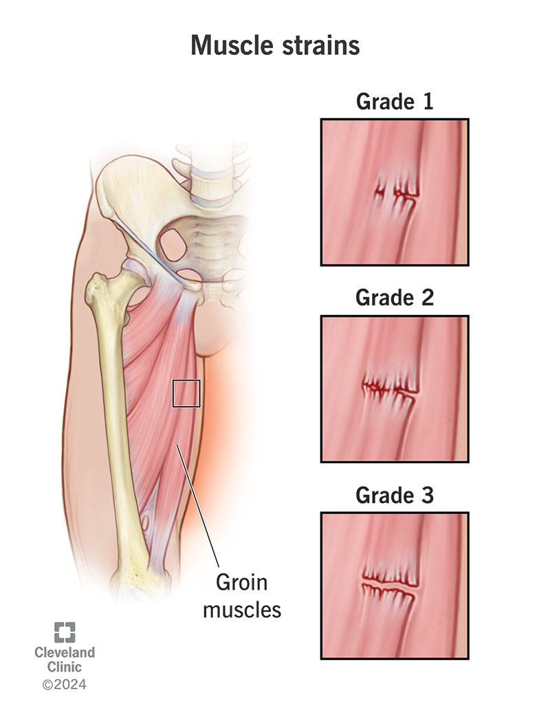 Three grades of muscle stains