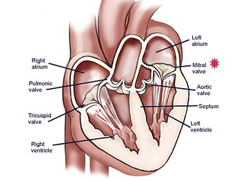 In mitral valve repair, surgeons fix problems with your mitral valve.