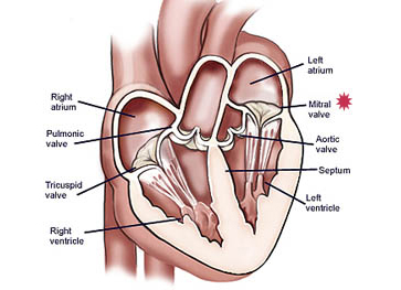 heart valve replacement surgery success